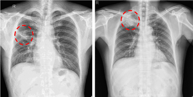 Figure 1 for Epoch-wise label attacks for robustness against label noise