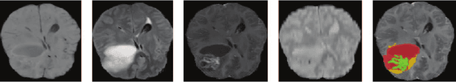 Figure 1 for A Tri-attention Fusion Guided Multi-modal Segmentation Network