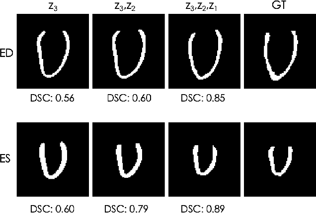 Figure 2 for Explainable Shape Analysis through Deep Hierarchical Generative Models: Application to Cardiac Remodeling