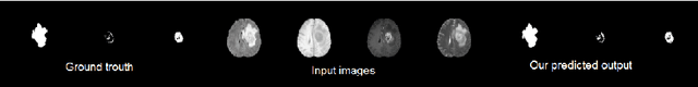 Figure 3 for Conditional Adversarial Network for Semantic Segmentation of Brain Tumor