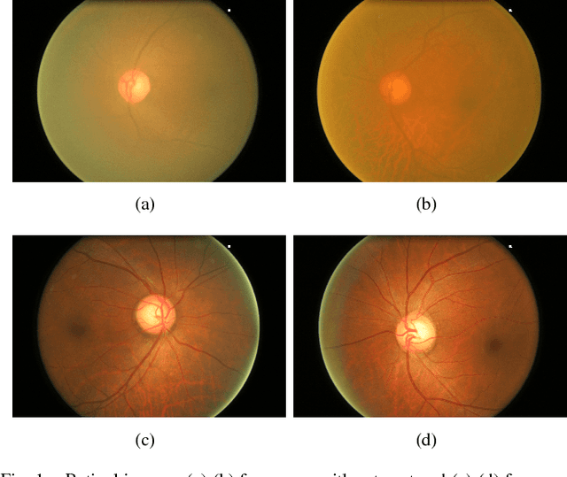 Figure 1 for Structure-preserving Guided Retinal Image Filtering and Its Application for Optic Disc Analysis