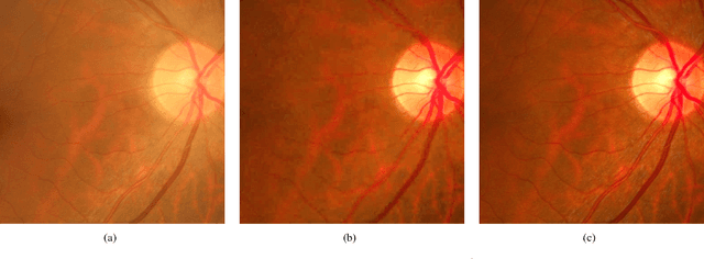 Figure 2 for Structure-preserving Guided Retinal Image Filtering and Its Application for Optic Disc Analysis