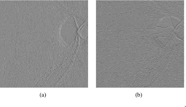 Figure 3 for Structure-preserving Guided Retinal Image Filtering and Its Application for Optic Disc Analysis