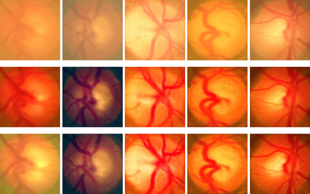 Figure 4 for Structure-preserving Guided Retinal Image Filtering and Its Application for Optic Disc Analysis