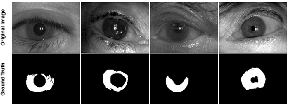 Figure 4 for SegDenseNet: Iris Segmentation for Pre and Post Cataract Surgery