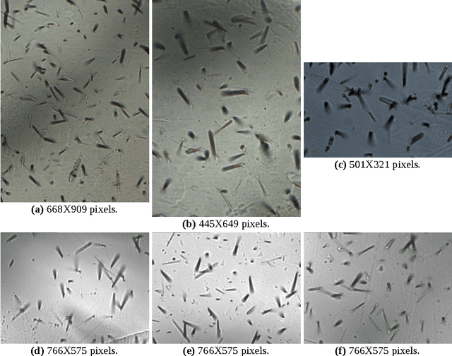 Figure 1 for An automatic method for segmentation of fission tracks in epidote crystal photomicrographs