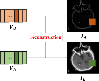 Figure 2 for A Medical Image Fusion Method based on MDLatLRRv2