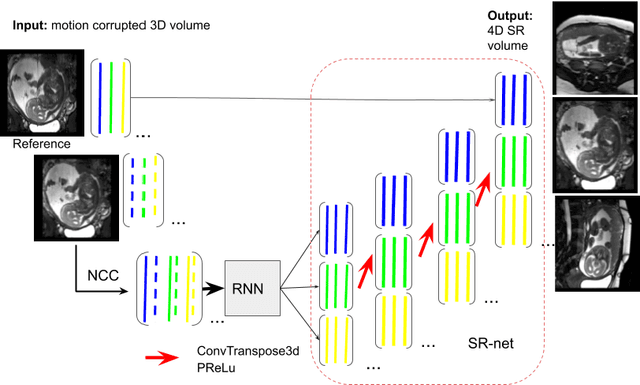 Figure 1 for Self-supervised Recurrent Neural Network for 4D Abdominal and In-utero MR Imaging