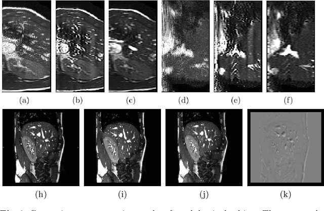 Figure 3 for Self-supervised Recurrent Neural Network for 4D Abdominal and In-utero MR Imaging