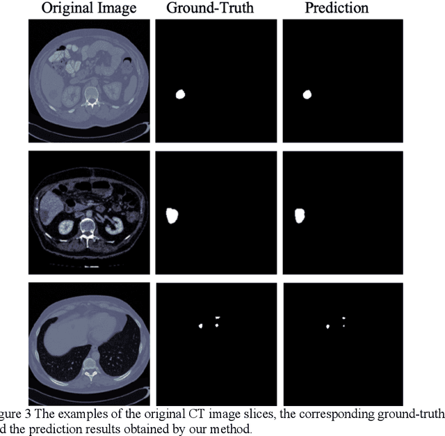 Figure 4 for Dual-Attention Enhanced BDense-UNet for Liver Lesion Segmentation
