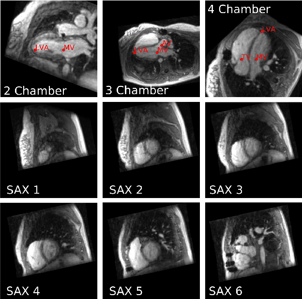 Figure 1 for Computationally efficient cardiac views projection using 3D Convolutional Neural Networks