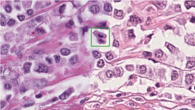 Figure 1 for Mitosis domain generalization in histopathology images -- The MIDOG challenge