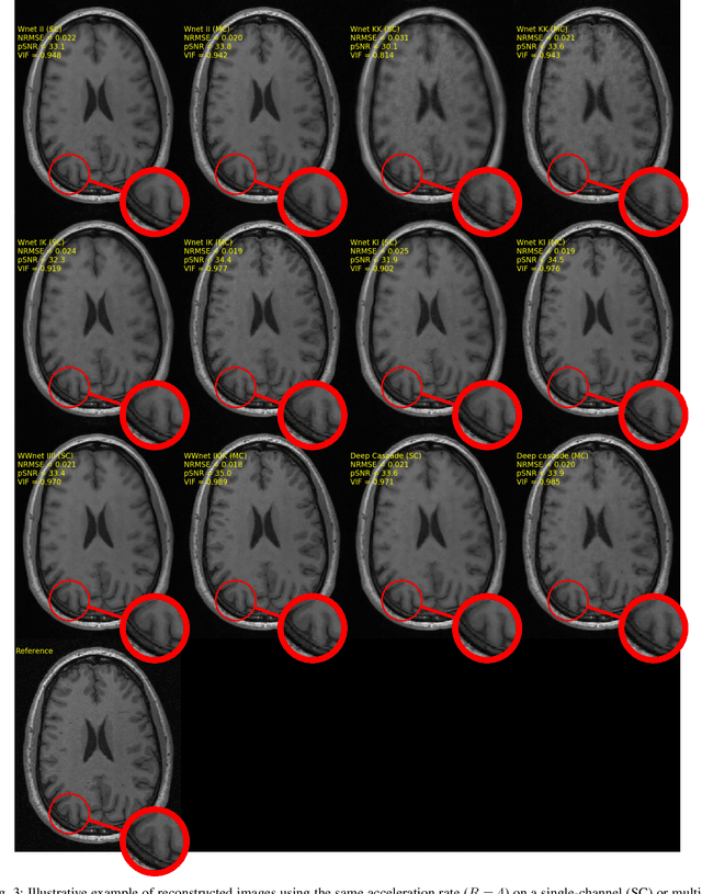 Figure 3 for Dual-domain Cascade of U-nets for Multi-channel Magnetic Resonance Image Reconstruction
