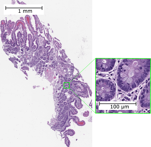 Figure 1 for Resolution-Based Distillation for Efficient Histology Image Classification