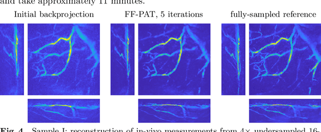 Figure 4 for Approximate k-space models and Deep Learning for fast photoacoustic reconstruction