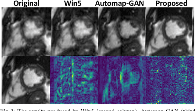 Figure 4 for Detection and Correction of Cardiac MR Motion Artefacts during Reconstruction from K-space