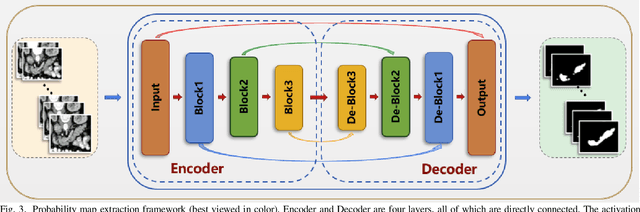 Figure 3 for Probability Map Guided Bi-directional Recurrent UNet for Pancreas Segmentation