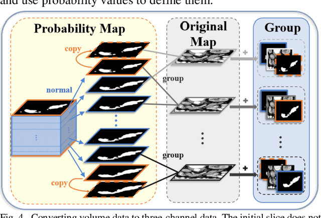 Figure 4 for Probability Map Guided Bi-directional Recurrent UNet for Pancreas Segmentation