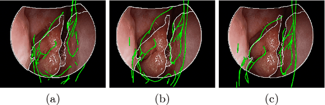 Figure 2 for Anatomically Constrained Video-CT Registration via the V-IMLOP Algorithm