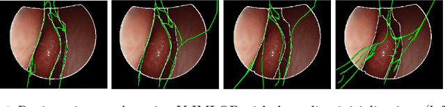 Figure 4 for Anatomically Constrained Video-CT Registration via the V-IMLOP Algorithm
