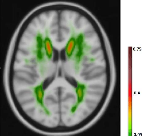 Figure 1 for Location Sensitive Deep Convolutional Neural Networks for Segmentation of White Matter Hyperintensities