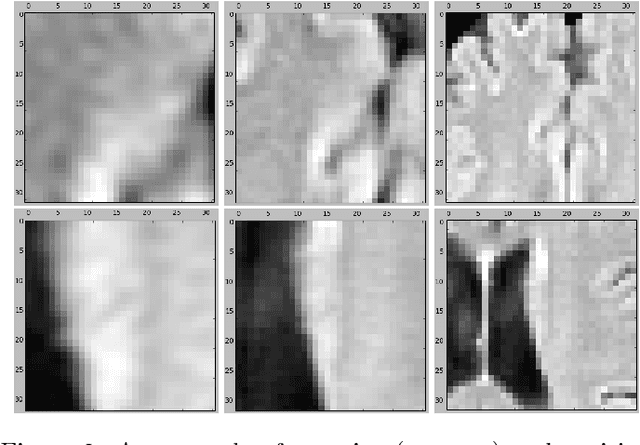 Figure 3 for Location Sensitive Deep Convolutional Neural Networks for Segmentation of White Matter Hyperintensities