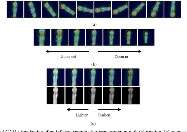 Figure 2 for PaXNet: Dental Caries Detection in Panoramic X-ray using Ensemble Transfer Learning and Capsule Classifier