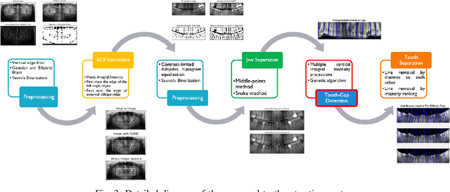 Figure 4 for PaXNet: Dental Caries Detection in Panoramic X-ray using Ensemble Transfer Learning and Capsule Classifier