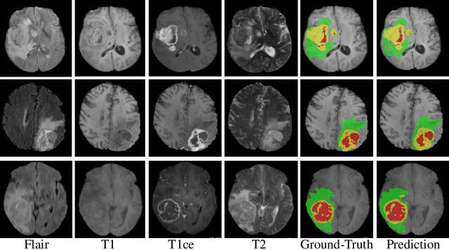 Figure 4 for Brain Tumor Segmentation and Survival Prediction using 3D Attention UNet