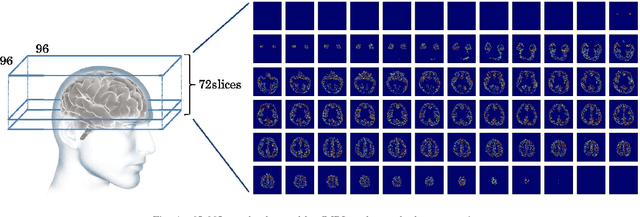 Figure 3 for Describing Semantic Representations of Brain Activity Evoked by Visual Stimuli