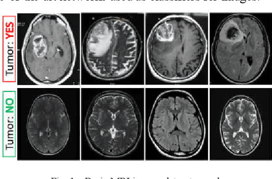 Figure 1 for Deep Convolutional Neural Networks Model-based Brain Tumor Detection in Brain MRI Images