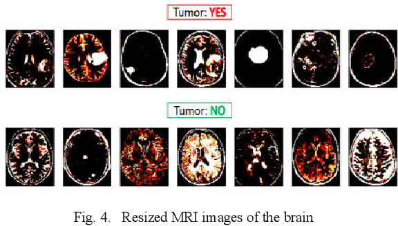 Figure 4 for Deep Convolutional Neural Networks Model-based Brain Tumor Detection in Brain MRI Images