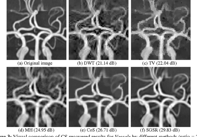 Figure 4 for Structural Group Sparse Representation for Image Compressive Sensing Recovery