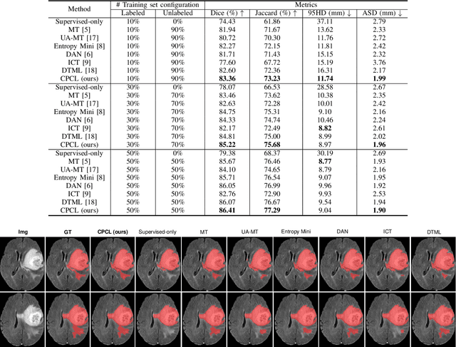 Figure 3 for All-Around Real Label Supervision: Cyclic Prototype Consistency Learning for Semi-supervised Medical Image Segmentation