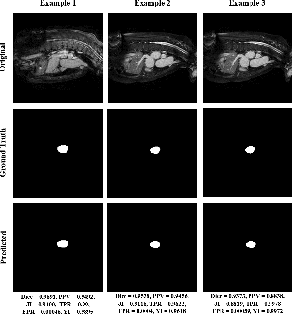 Figure 4 for Heart Segmentation From MRI Scans Using Convolutional Neural Network
