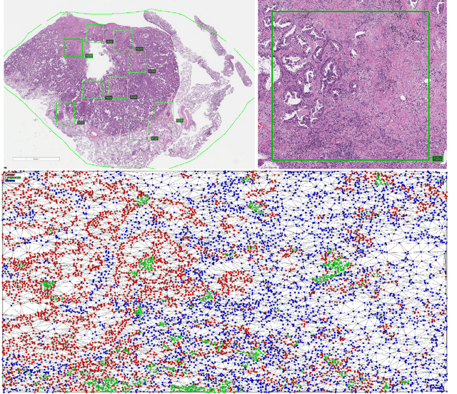 Figure 1 for An Approach for Clustering Subjects According to Similarities in Cell Distributions within Biopsies