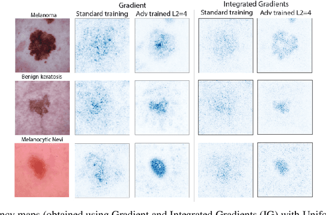 Figure 1 for Improving Interpretability in Medical Imaging Diagnosis using Adversarial Training