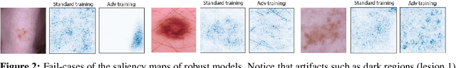 Figure 2 for Improving Interpretability in Medical Imaging Diagnosis using Adversarial Training