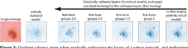 Figure 3 for Improving Interpretability in Medical Imaging Diagnosis using Adversarial Training
