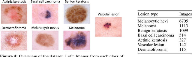 Figure 4 for Improving Interpretability in Medical Imaging Diagnosis using Adversarial Training