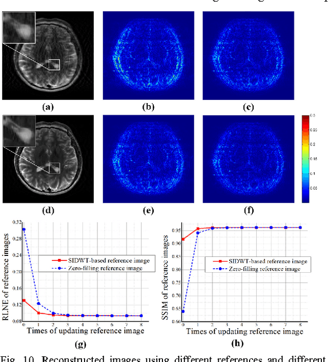 Figure 3 for Fast Multi-class Dictionaries Learning with Geometrical Directions in MRI Reconstruction