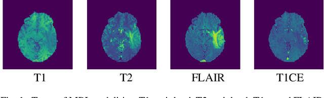 Figure 1 for Multi-channel MRI Embedding: An EffectiveStrategy for Enhancement of Human Brain WholeTumor Segmentation