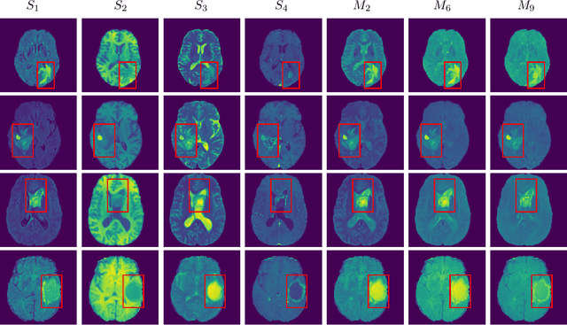 Figure 3 for Multi-channel MRI Embedding: An EffectiveStrategy for Enhancement of Human Brain WholeTumor Segmentation