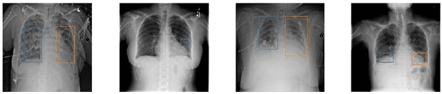 Figure 1 for Deep Compressed Pneumonia Detection for Low-Power Embedded Devices