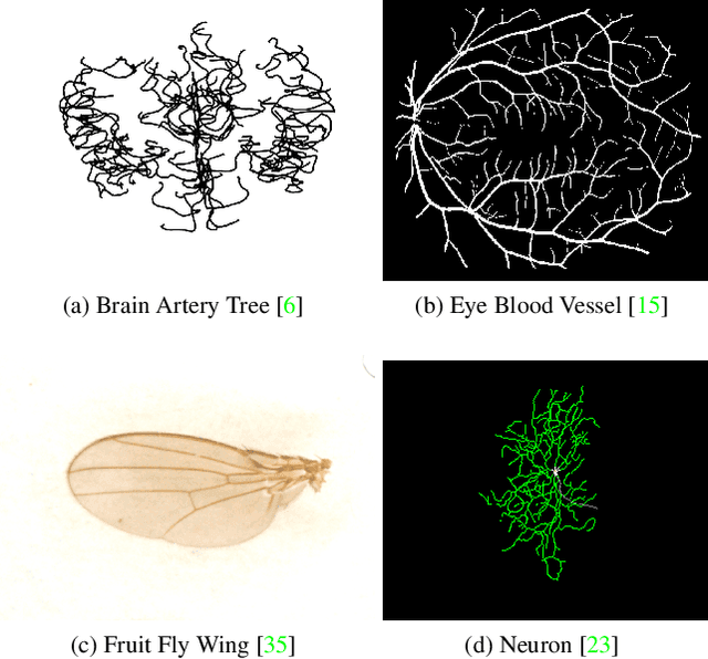 Figure 1 for Representations, Metrics and Statistics For Shape Analysis of Elastic Graphs