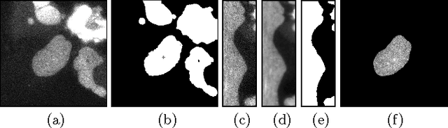 Figure 1 for Automated Image Processing for the Analysis of DNA Repair Dynamics