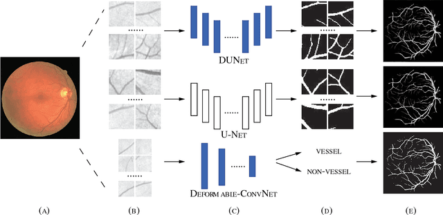 Figure 1 for DUNet: A deformable network for retinal vessel segmentation
