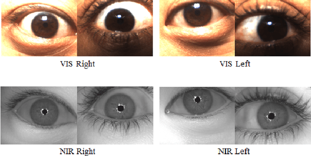 Figure 4 for Cross-spectral Periocular Recognition: A Survey