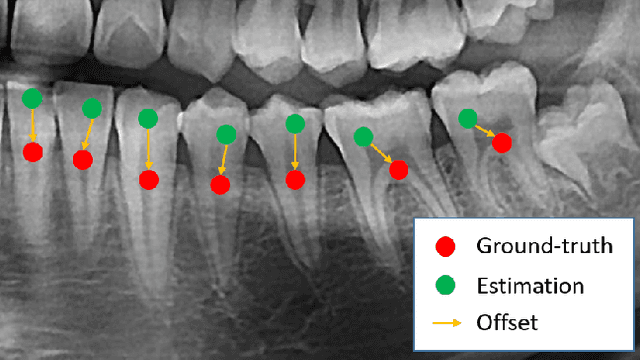 Figure 2 for Individual Tooth Detection and Identification from Dental Panoramic X-Ray Images via Point-wise Localization and Distance Regularization