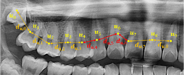 Figure 4 for Individual Tooth Detection and Identification from Dental Panoramic X-Ray Images via Point-wise Localization and Distance Regularization